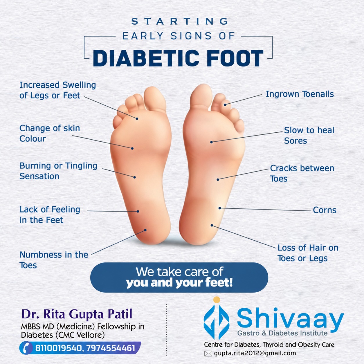 Diabetic Foot Treatment in Indore